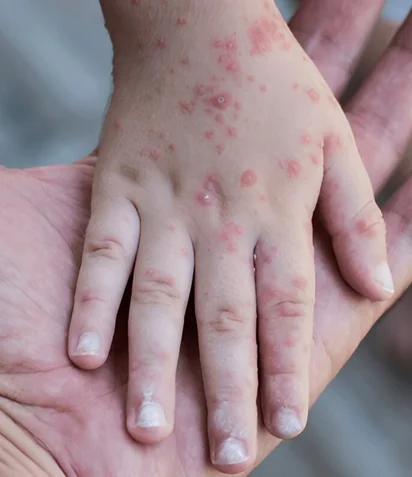 Rug Cleaning Process